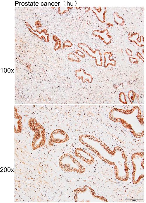 bg3 anti ethes mirro,bg3 anti ethes mirro: A Comprehensive Overview