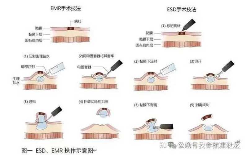 esd to eth,Understanding ESD to ETH: A Comprehensive Guide